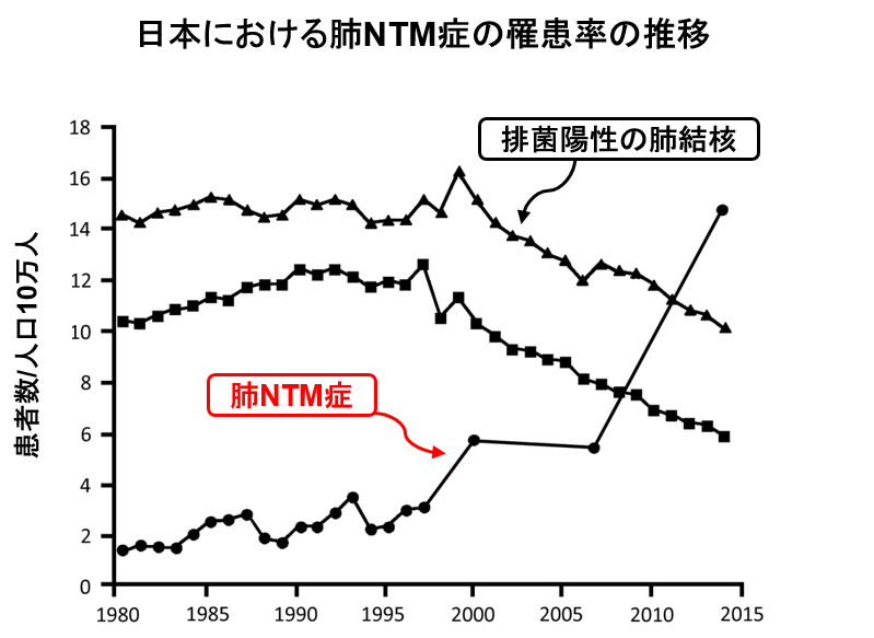 肺放線菌症はどのように治療されますか?